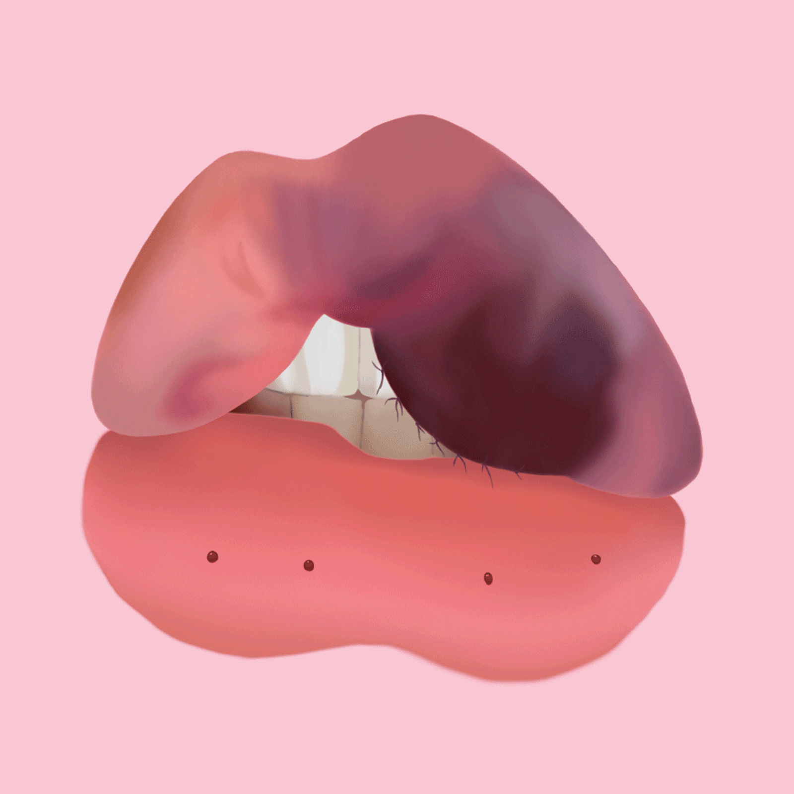 Dysmorphia Lips