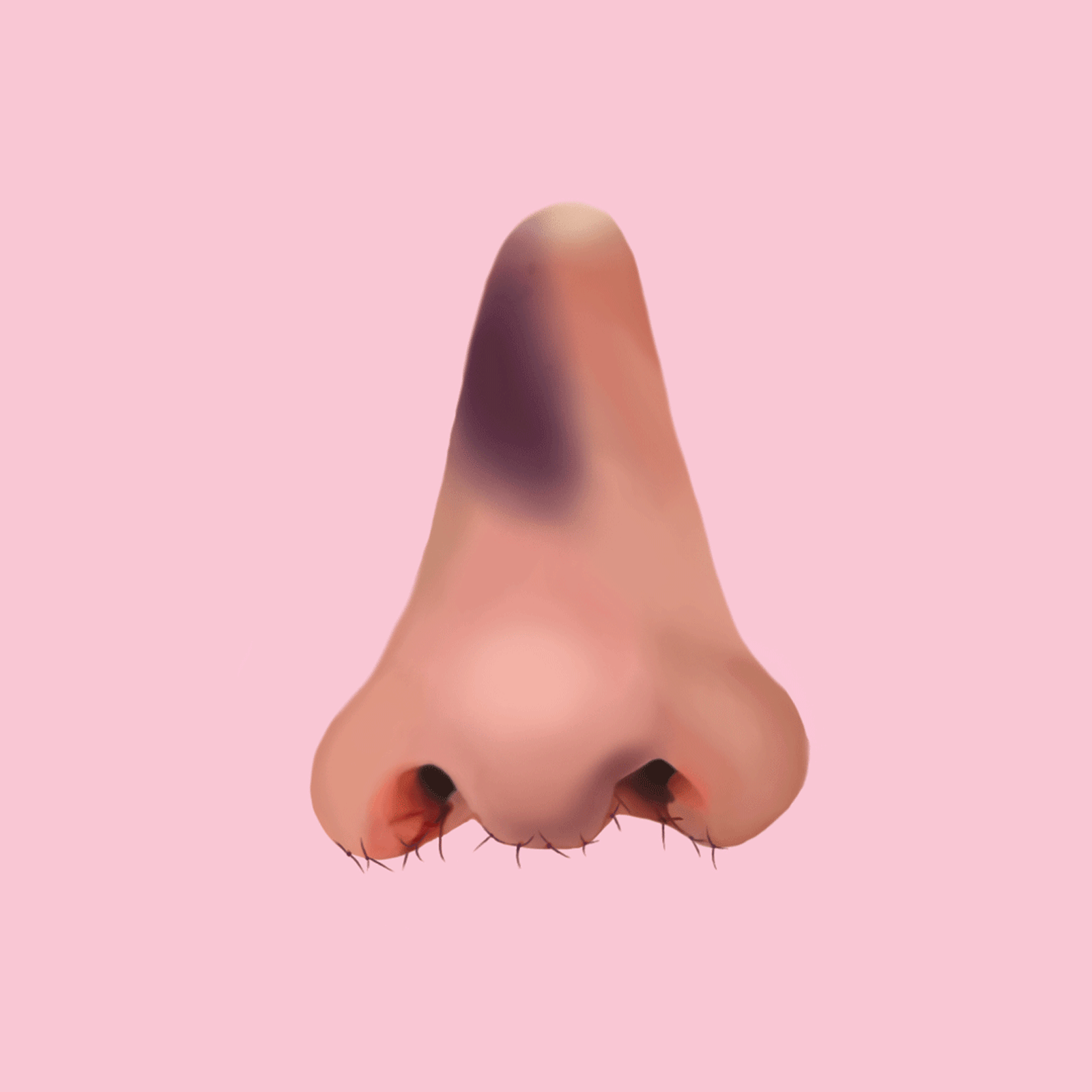 Dysmorphia Nose
